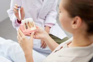 how to prepare for dental implant